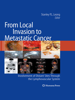 cover image of From Local Invasion to Metastatic Cancer